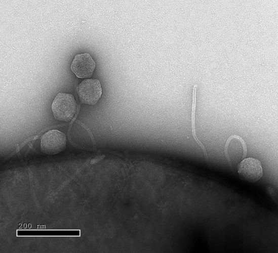 וירוסים המדביקים חיידקי אי-קולי (צילום: מכון ויצמן למדע)